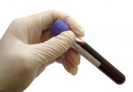 Why is the UK lagging behind the rest of Europe in cancer survival?